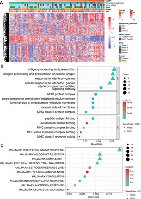 GOLM1 is related to the inflammatory/immune nature of uveal melanoma and acts as a promising indicator for prognosis and immunotherapy response